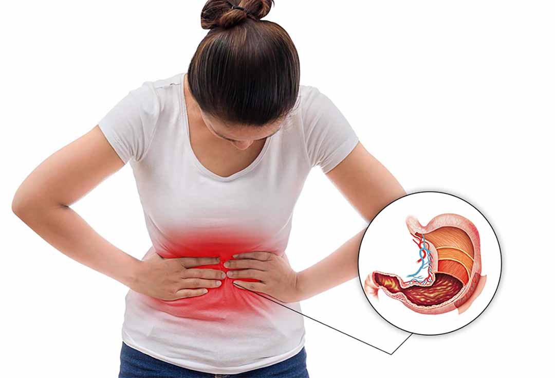 Bí quyết chăm sóc dạ dày tự nhiên với Bột Hoài Sơn